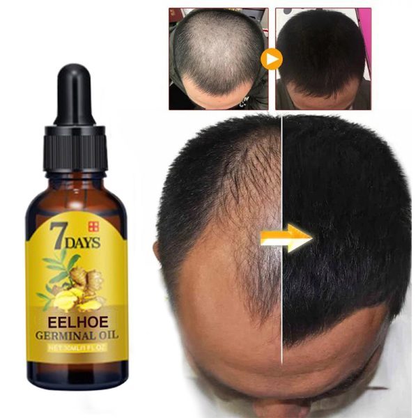 EELHOE Ginger Treatment Essence Hair Strengthening 40ml packaging and label