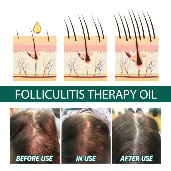 EELHOE Oil Hair Strengthening 30ml/ packaging and label