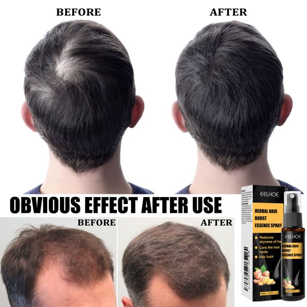 EELHOE Oil Scalp Care 30ml/ front view