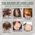 Rosemary Oil Anti Hair Loss Treatment | EELHOE 30pcs