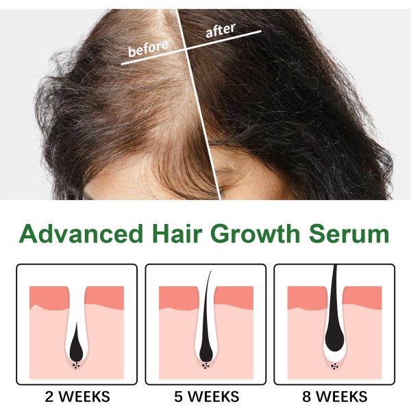 EELHOE Serum Hair Strengthening 30ml - product photo 4