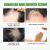 Rosemary Oil Anti Hair Loss Treatment | EELHOE 30ml