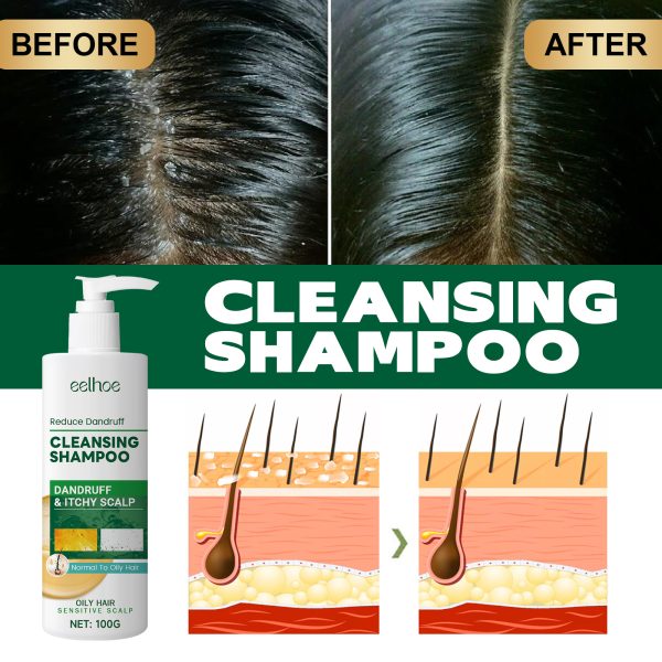 EELHOE Shampoo Oil Control 100g - product photo 4