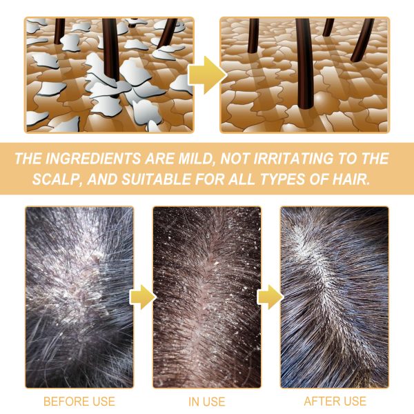 Betaine Scalp Treatment | EELHOE 100g