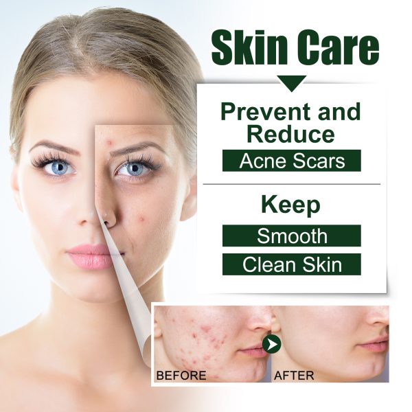 EELHOE Tea Tree Serum Nourishing 30ml/ packaging and label