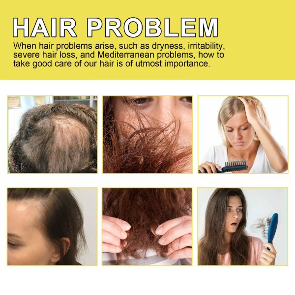hoegoa-hair-care-product-nourishing-30ml-2 Hoegoa Hair Care Product Nourishing 30ml/盒