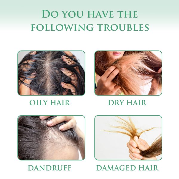 Hoegoa Hair Care Product Oil Control 100g