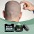 Glycerin & Mineral Oil Hair Growth Serum | HOEGOA 50g