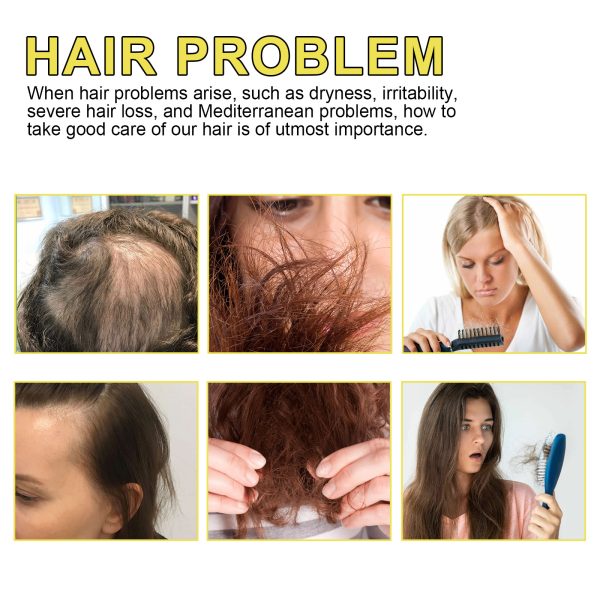 Hoegoa Oil Hair Strengthening 30ml/盒