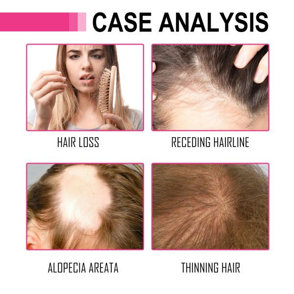 hoegoa-oil-hair-strengthening-70ml-2 Hoegoa Oil Hair Strengthening 70ml