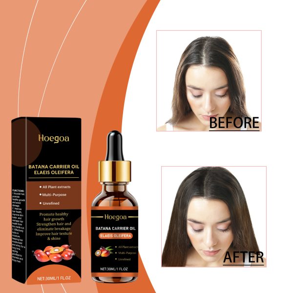 Beta-Carotene & Ginger Scalp Treatment | HOEGOA 30ml