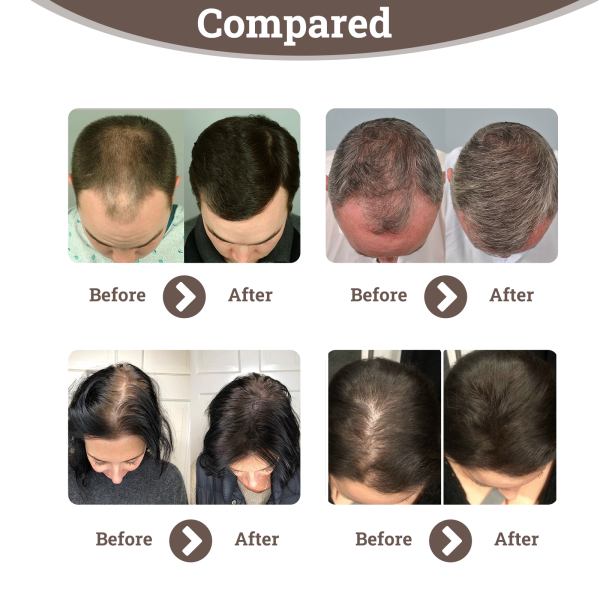 Hoegoa Spray Hair Strengthening 30ml - product photo 4
