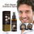 Ginger & Angelica Anti Hair Loss Treatment | HOEGOA 30ml