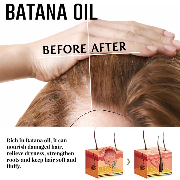 Batana Oil Anti Hair Loss Treatment | JAYSUING 15ml