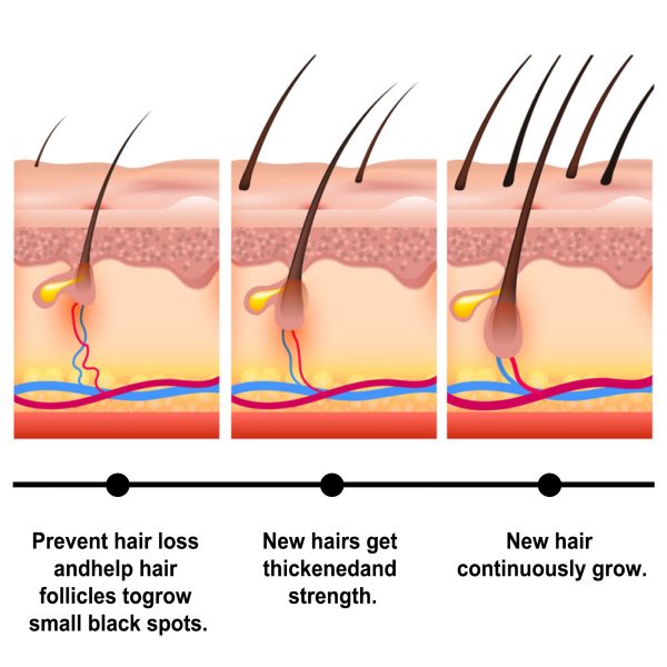 Mineral Oil Anti Hair Loss Treatment | JAYSUING 30ml