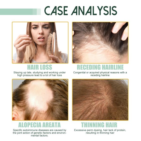 JAYSUING Oil Hair Strengthening 30ml/ packaging and label