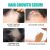 Glycerin & Ginger Anti Hair Loss Treatment | JAYSUING 20ml