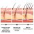 Fleeceflower Root Extract Anti Hair Loss Treatment | JAYSUING ...