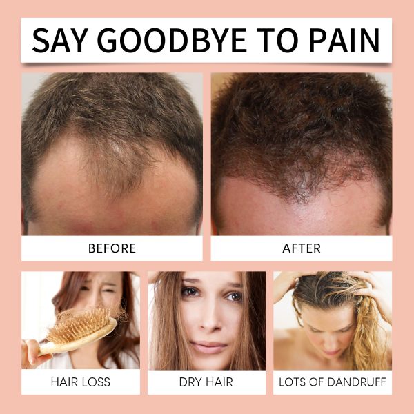 OUHOE Hair Mask Oil Control 100g
