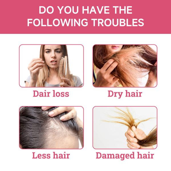 ouhoe-oil-hair-strengthening-30ml-2 OUHOE Oil Hair Strengthening 30ml/盒