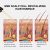 Glycerin & Butylene Glycol Anti Hair Loss Treatment | OUHOE 30ml