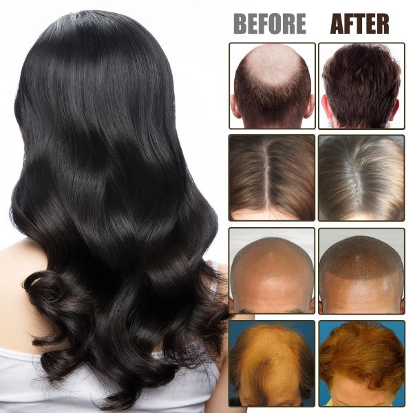OUHOE Serum Hair Strengthening 30ml - product photo 4