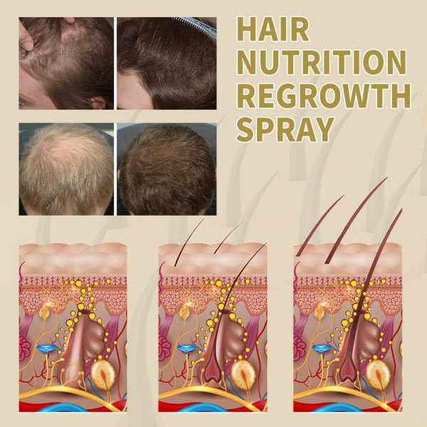 OUHOE Spray Hair Strengthening 30ml/ packaging and label