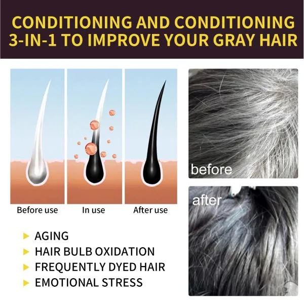 Scalp Treatment | EELHOE 30ml