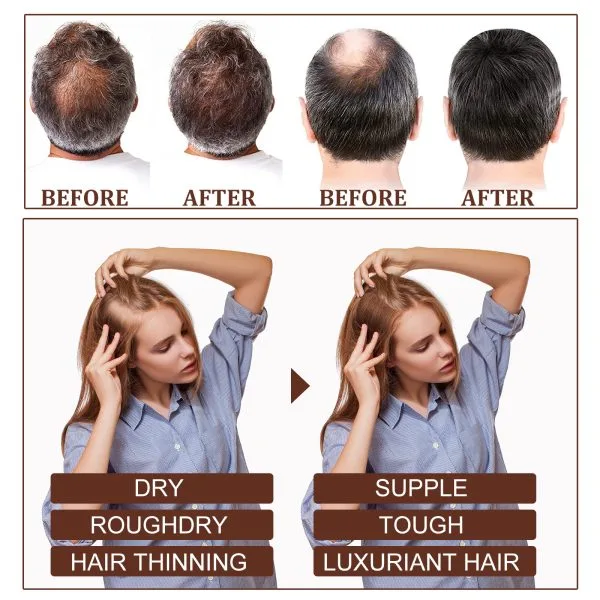 Scalp Treatment | EELHOE 30ml