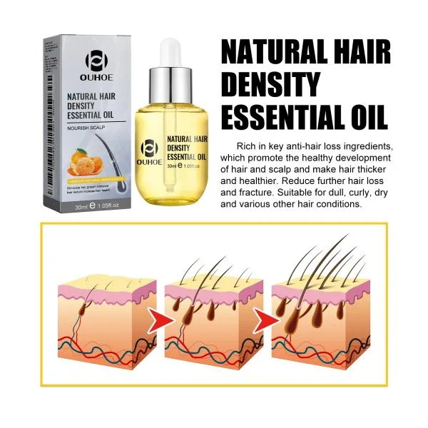 Scalp Treatment | OUHOE 30ml