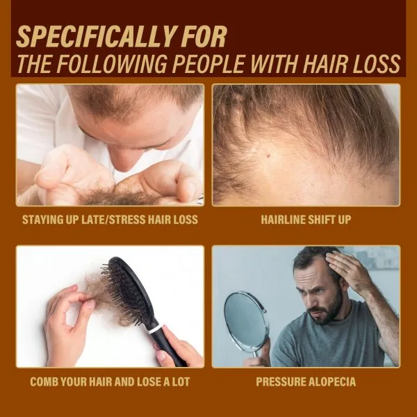 Scalp Treatment | OUHOE 6ml