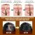 Scalp Treatment | OUHOE 6ml
