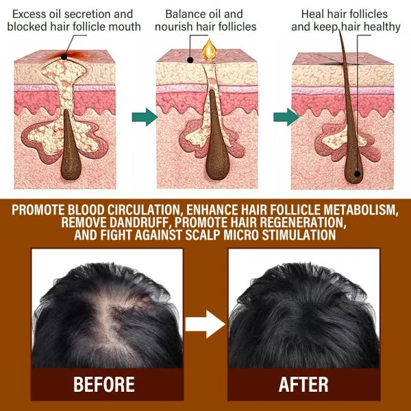 Scalp Treatment | OUHOE 6ml