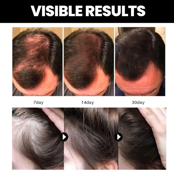 Hair Styling Treatment | OUHOE 35ml