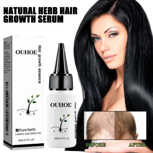 Scalp Treatment | OUHOE 20ml