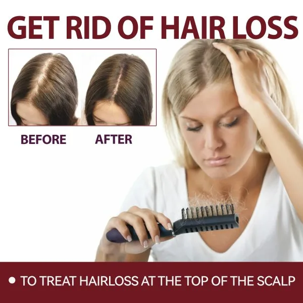 Scalp Treatment | OUHOE 50ml