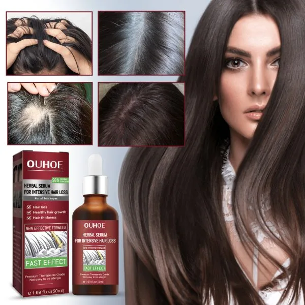 Scalp Treatment | OUHOE 50ml