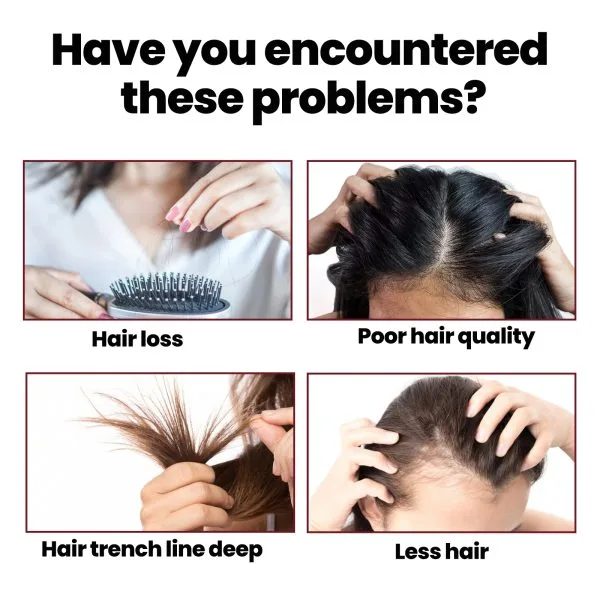 Scalp Treatment | OUHOE 50ml