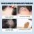 Scalp Treatment | East 3ml
