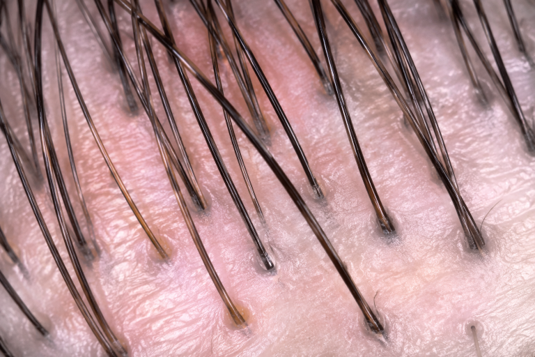 scalp health - hair growth related image