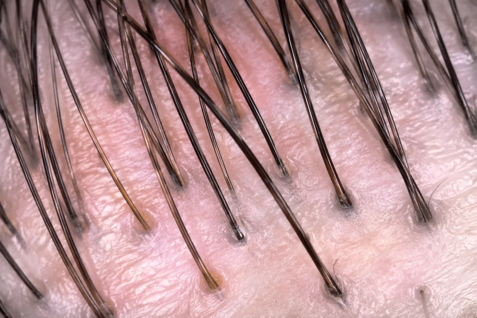 How to Interpret Hair Loss Blood Work: What Each Marker Means