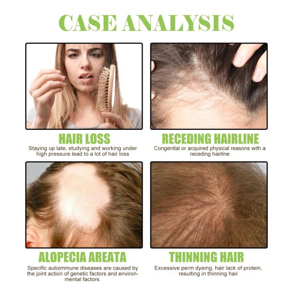 Fleeceflower Root & Ginger Scalp Treatment | South Moon