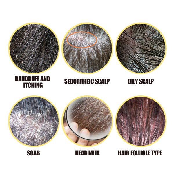 South Moon Hair Care Product Oil Control 50g packaging and label