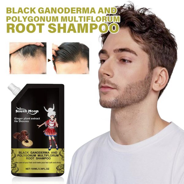 Fleeceflower Root Anti Hair Loss Treatment | South Moon 100ml