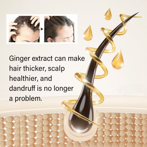 Fleeceflower Root Anti Hair Loss Treatment | South Moon 100ml