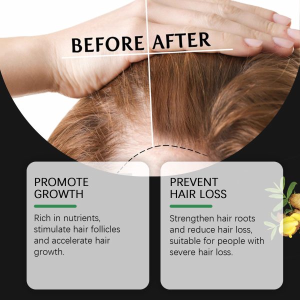 Mineral Oil & Palm Oil Hair Growth Serum | West&Month 30ml