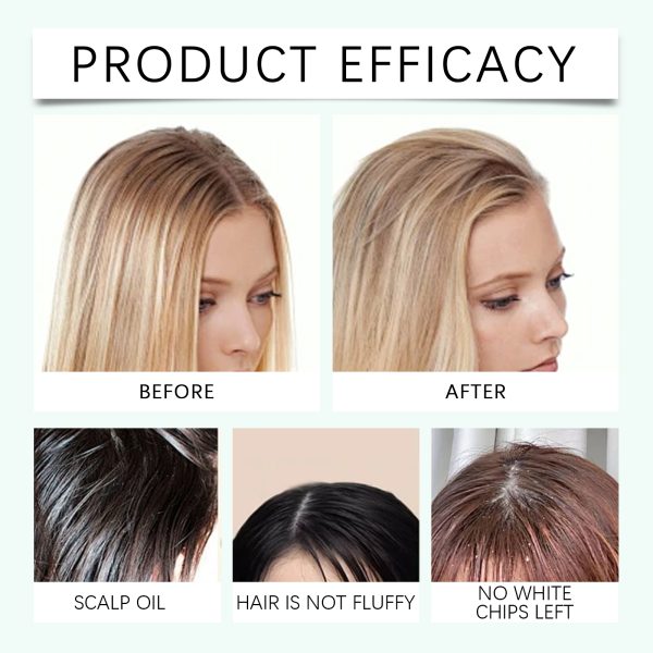 Aloe Vera Hair Thickening Treatment | West&Month 100ml