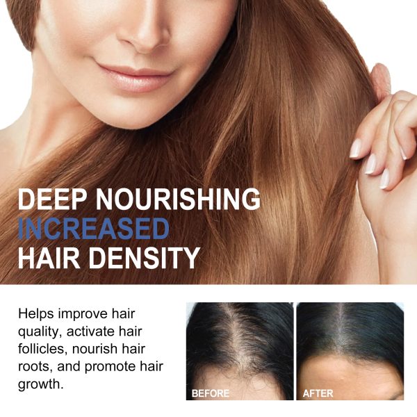 wiyun-hair-care-product-hair-strengthening-30g-7-1.jpg Ginseng & Ginger Hair Thickening Treatment 30g